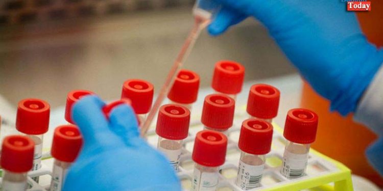 जमातियों के सम्पर्क में आए कोरोना के 2 और मरीज मिले, 12 साल का बच्चा भी संक्रमित