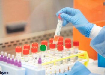 बैंक अधिकारी के सम्पर्क में आए लोगों का भेजा गया सैंपल, उझानी के सुरक्षा गार्ड की भी होगी जाँच