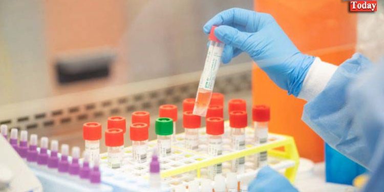 बैंक अधिकारी के सम्पर्क में आए लोगों का भेजा गया सैंपल, उझानी के सुरक्षा गार्ड की भी होगी जाँच