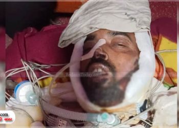 सहसवान कोतवाली में पेट्रोल डालकर आत्मदाह करने वाले युवक की मौत, पुलिस प्रताड़ना से था परेशान